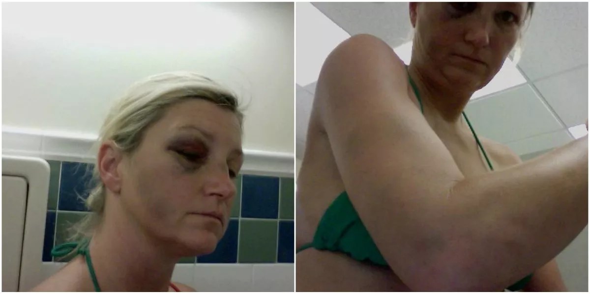 Broward Deputies Sued After Beating Jailed Woman Who Asked for Tampon
