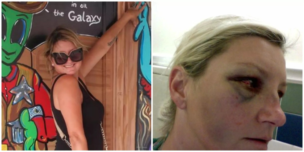 Broward Sheriff’s Office to Pay $185,000 to Woman Beaten by Jail Guards