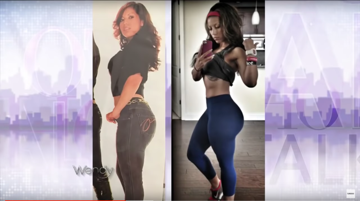 Fitness Instagrammer Sues Miami Plastic Surgeon for Botched Butt-Injection Removal